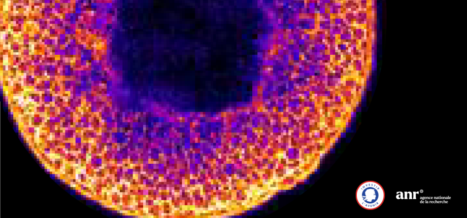 Morphoscope - Photonic Microscopy 